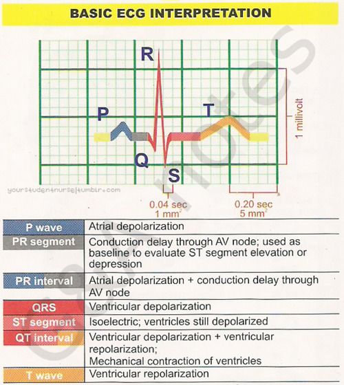 cardiac