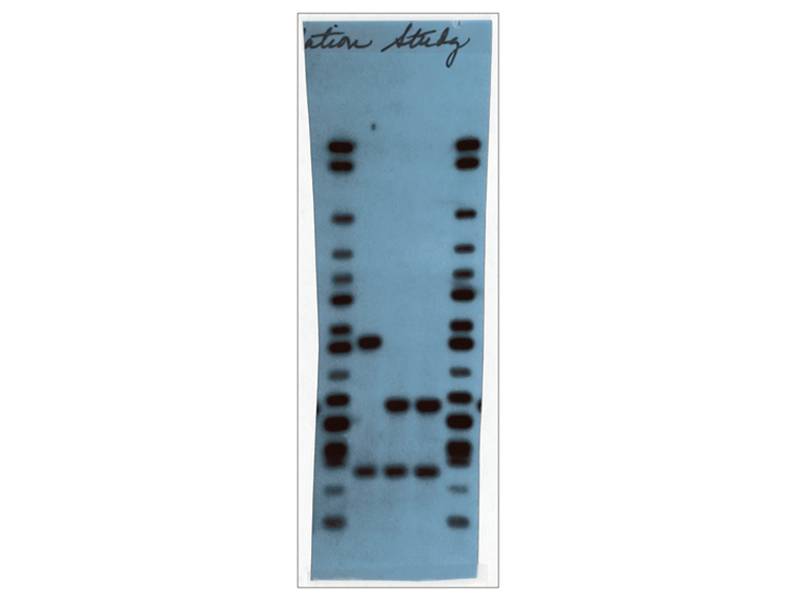 A DNA fingerprint.