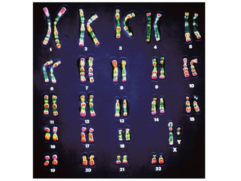 A human karyotype. 