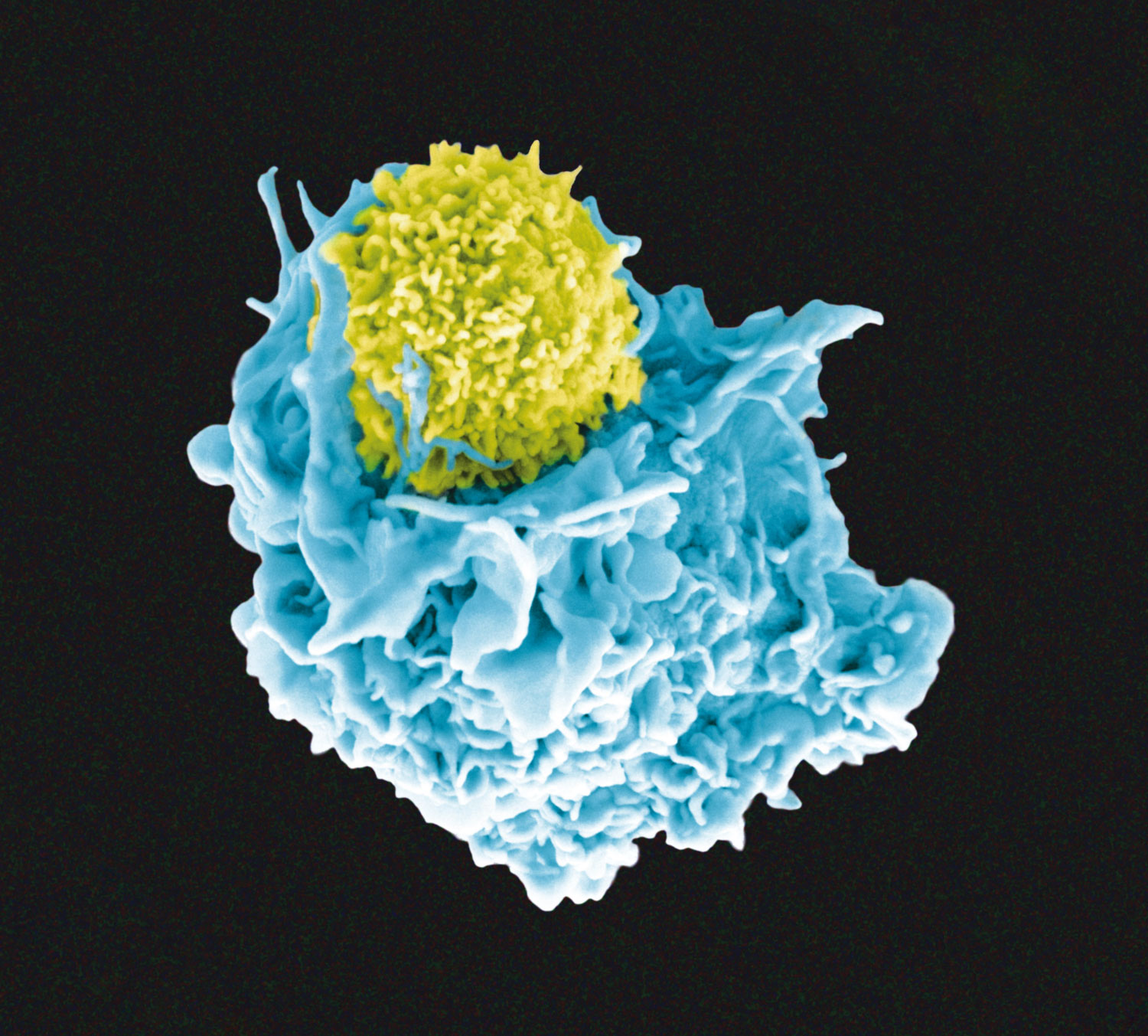 An antigen-presenting dendritic cell (blue) interacting with a T cell (yellow)