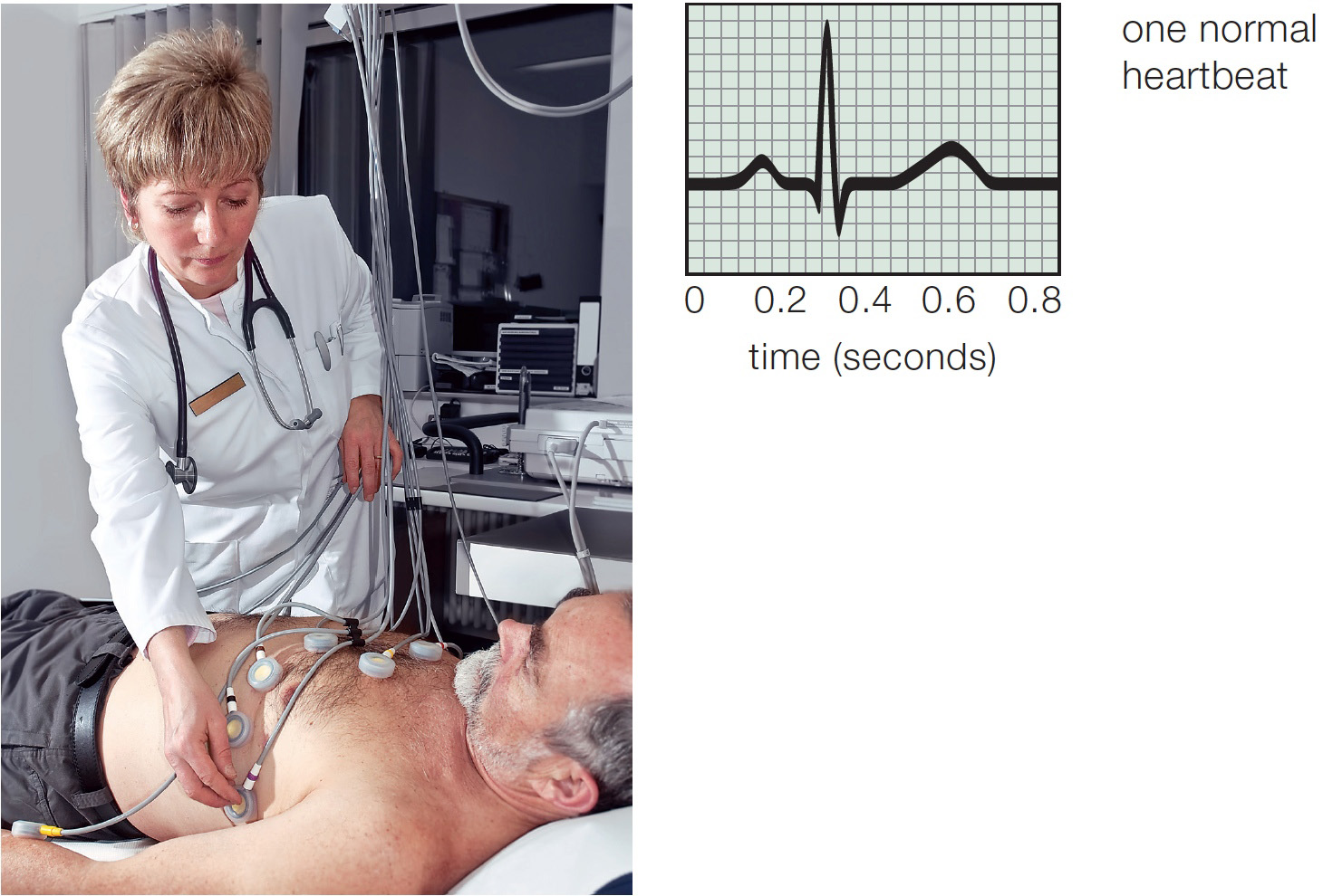 Electrocardiograms