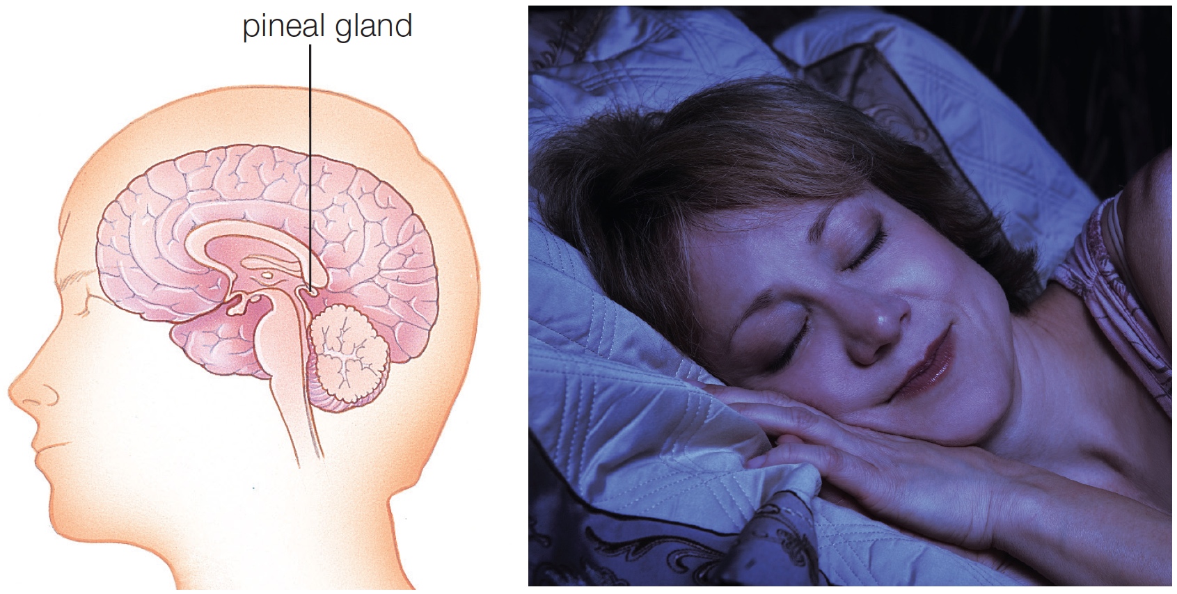 Location of the human pineal gland