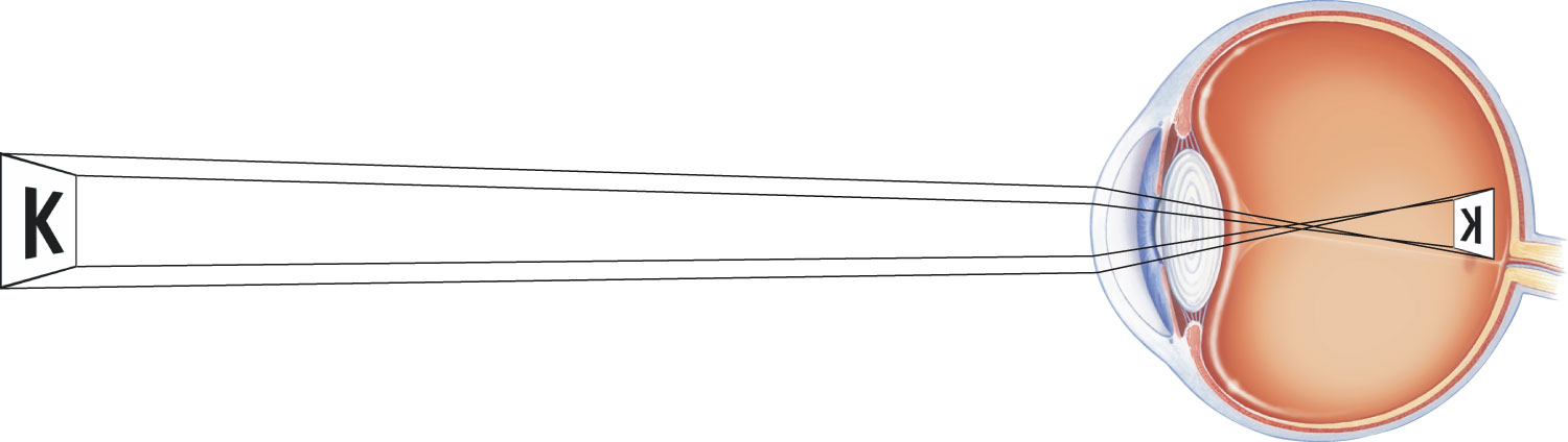 Pattern of Retinal Stimulation