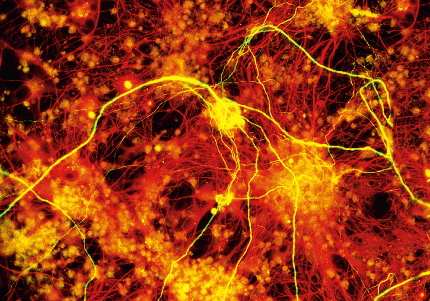 Neuron and Astrocytes