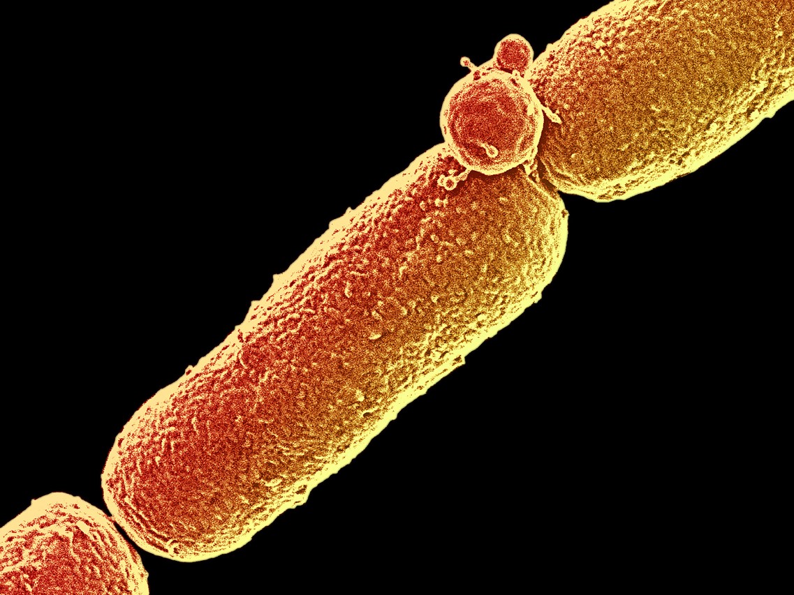 Anthrax bacteria (Bacillus anthracis)