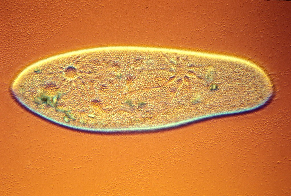 This living protozoan is the common Paramecium multimicronucleatum that moves by means of its numero