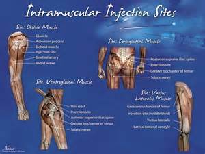 Intramuscular Injection Site