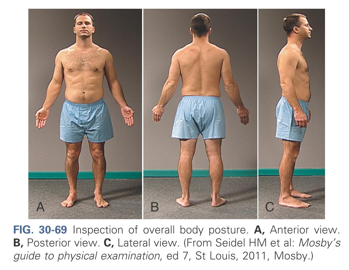 Inspection of overall body posture