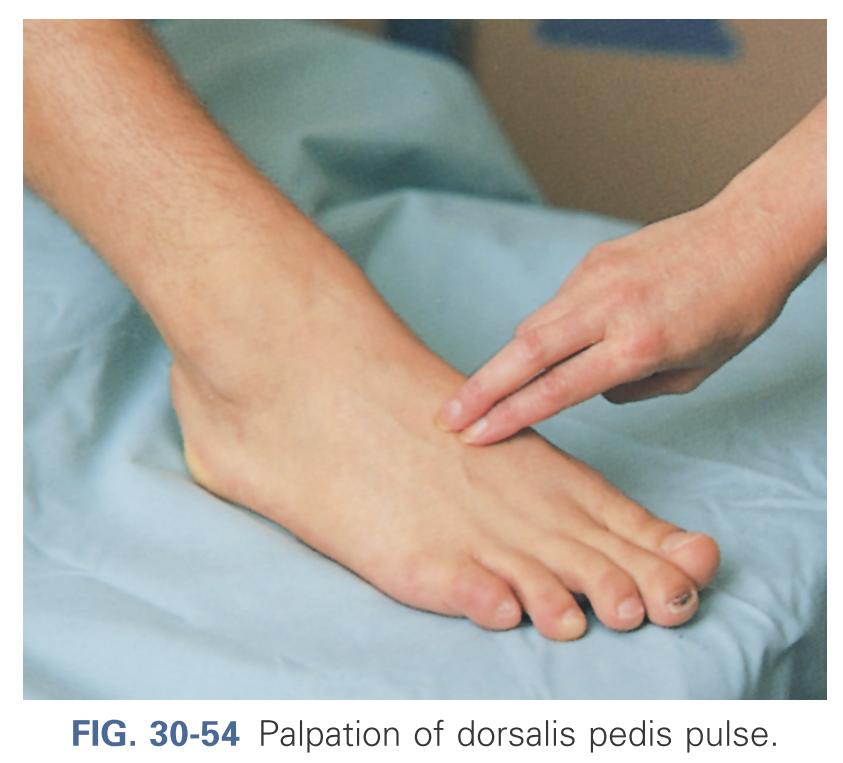 Palpation of dorsalis pedis pulse