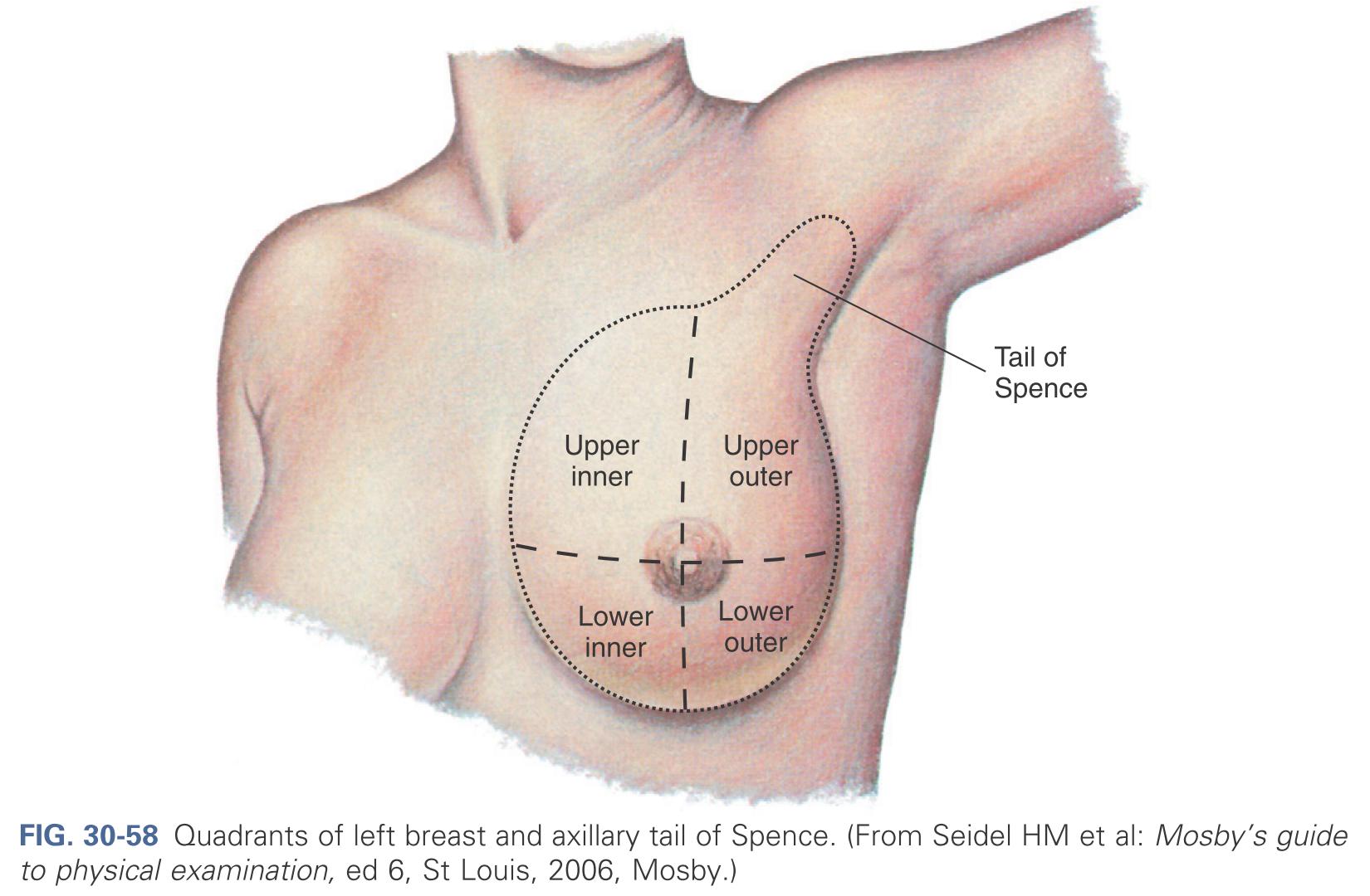 Quadrants of left breast and axillary tail of spence