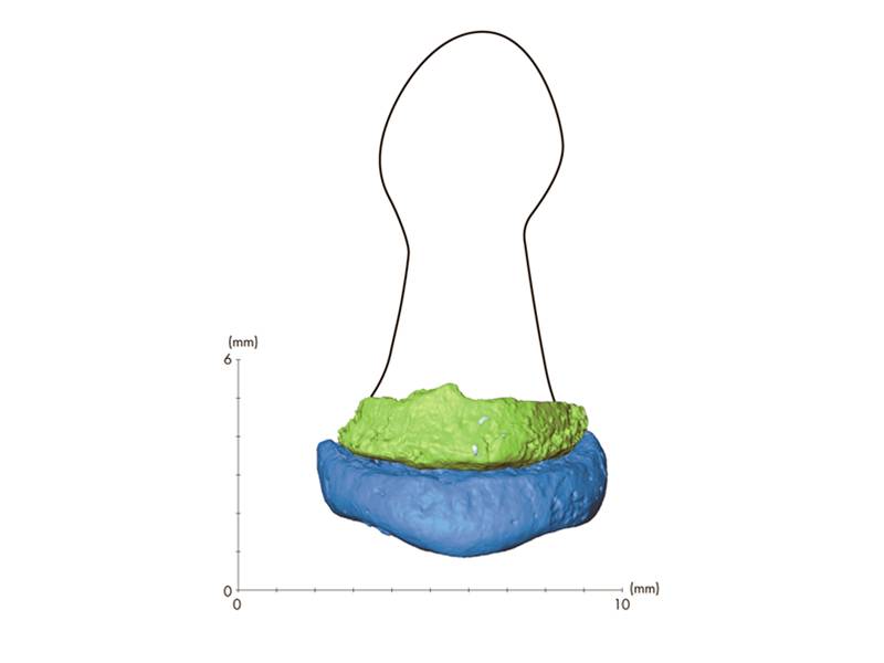 A Dorsal view of a scan of the hand phalange of a child from Denisova that yielded mtDNA that differ