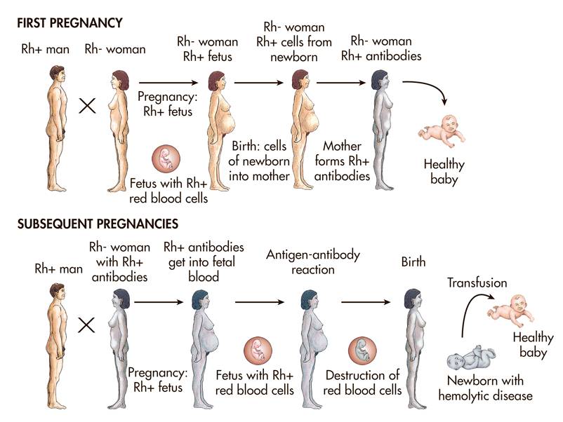 Maternal-fetal incompatibility in the Rh system.   