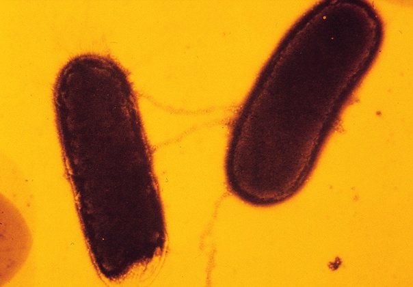 Bacteria Undergoing Conjugation