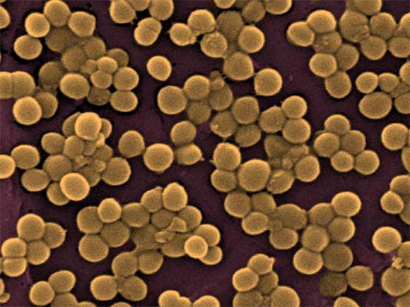 Staphylococcus genus