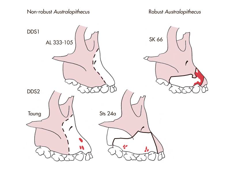 Comparing fossil patterns of the Hadar Baby, the Taung Child, and Au. Robustus.