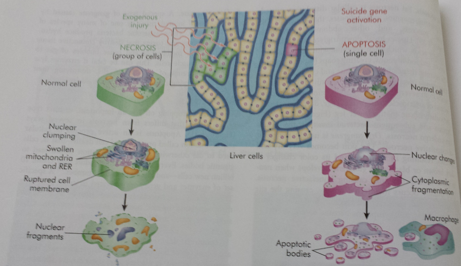 Necrosis & Apoptosis in Liver Cells