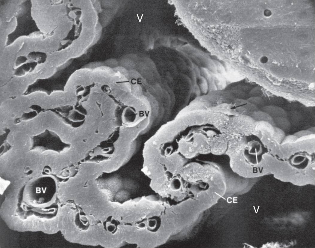 A Scanning Electron Micrograph of the Choroid Plexus