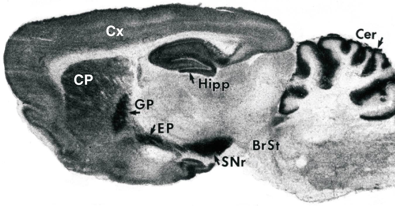 Cannabinoid Receptors in a Rat Brain 