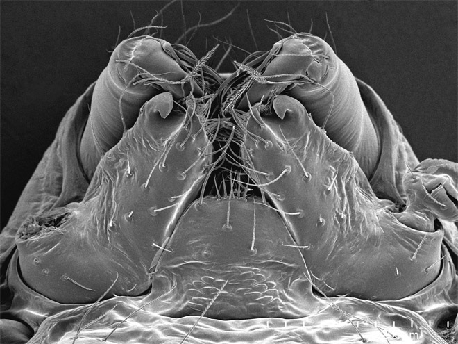 Scorpions, Spiders and Sharks: Electron-Microscope Images