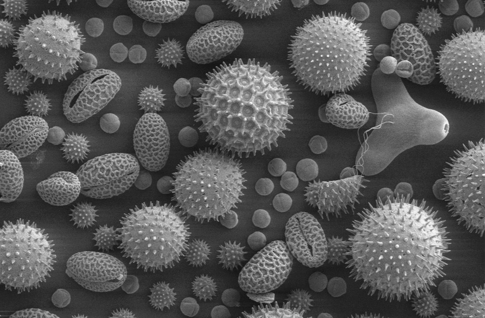 Pollen from a variety of common plants