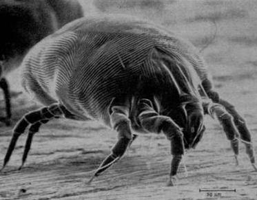 Dust Mite