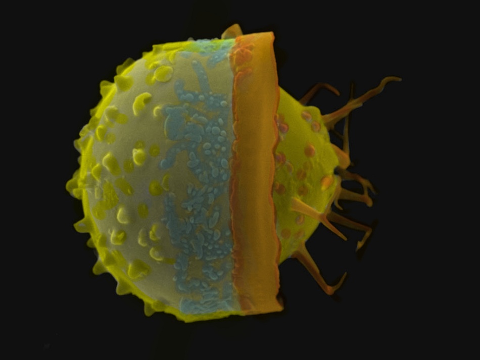 electron microscope image of a diatom