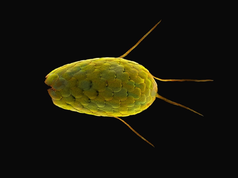 Electron Microscope Images of a Diatom