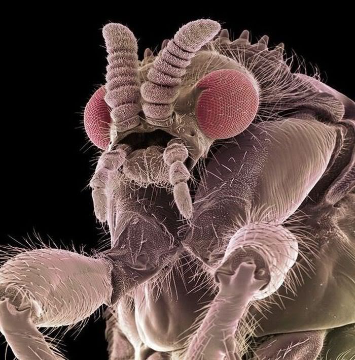 Insects Under the Electron Microscope