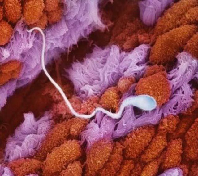 Sperm in the fallopian tube.