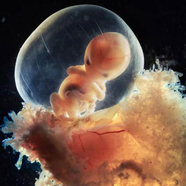 Eight weeks old human embryo