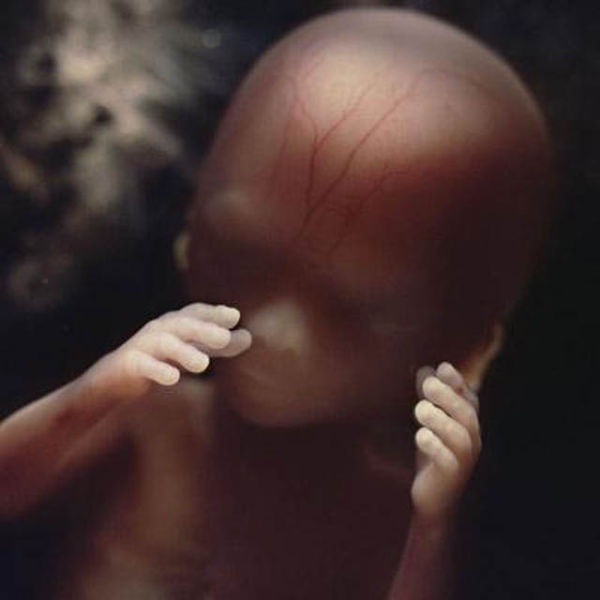 16 weeks old human fetus