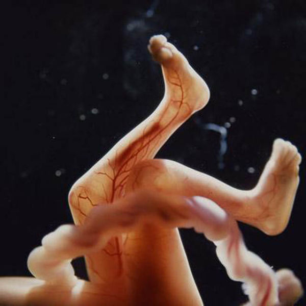 Fetal development of human