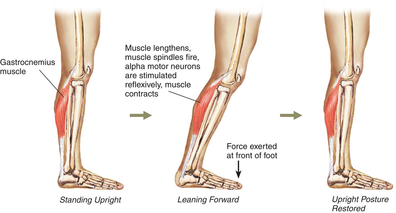 The Role of the Monosynaptic Stretch Reflex in Postural Control