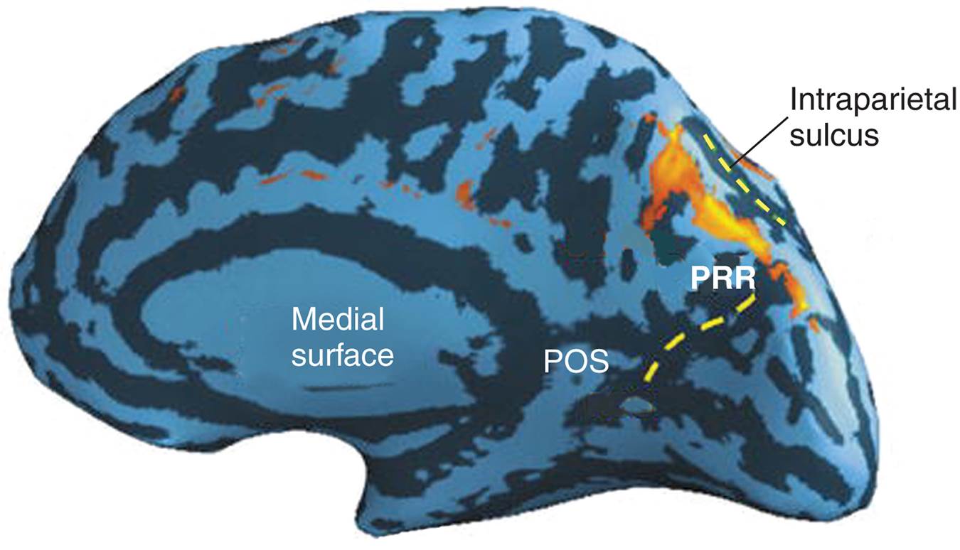 The Parietal Reach Region 