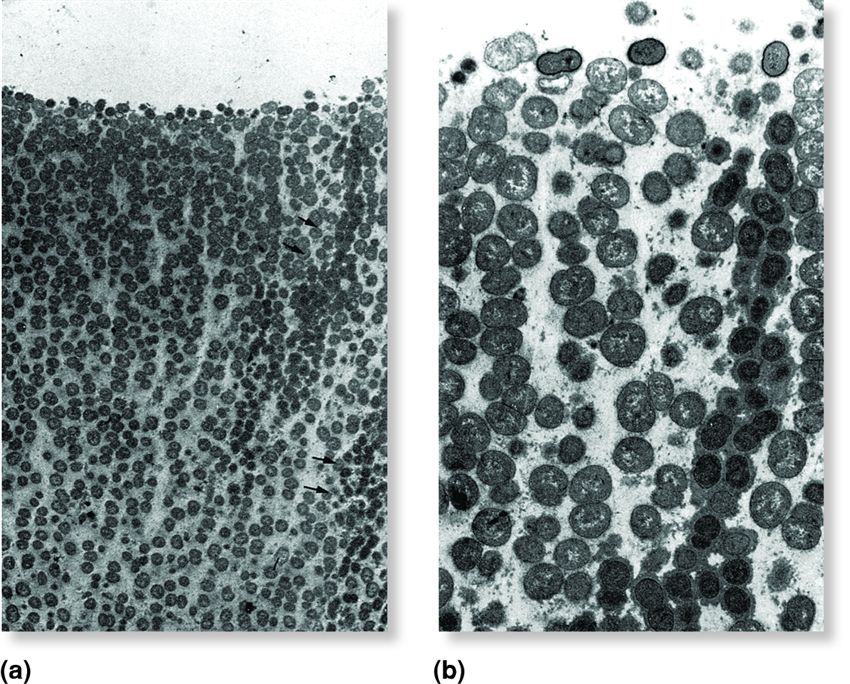 A biofilm composed of a community of microorganisms glued by mucilage to a surface.