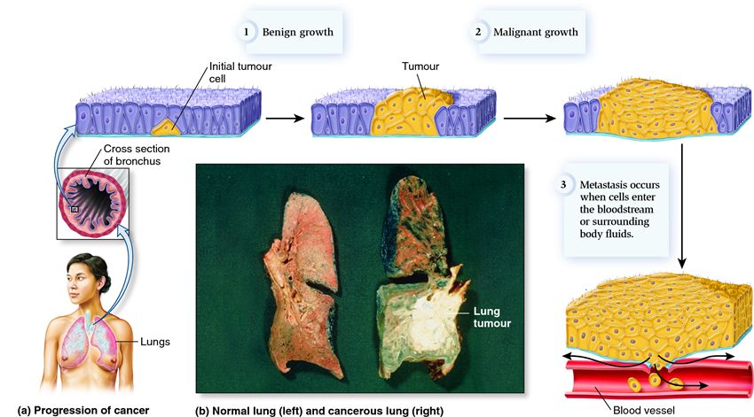 The progression and effects of cancer.