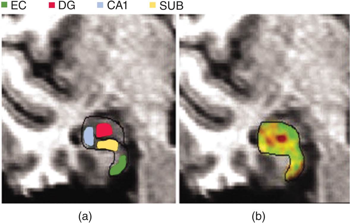 Exercise and Neurogenesis 