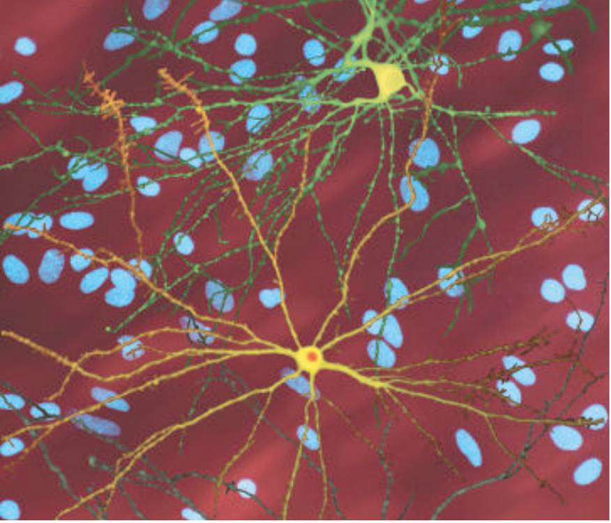 Infection with Abnormal Huntingtin 