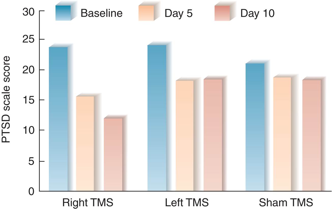 Transcranial Magnetic Stimulation and PTSD 