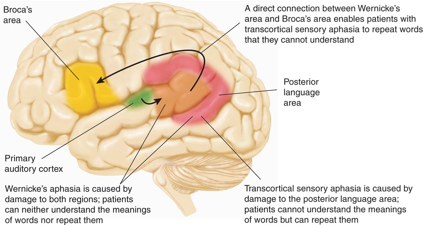 Transcortical Sensory Aphasia and Wernicke’s Aphasia