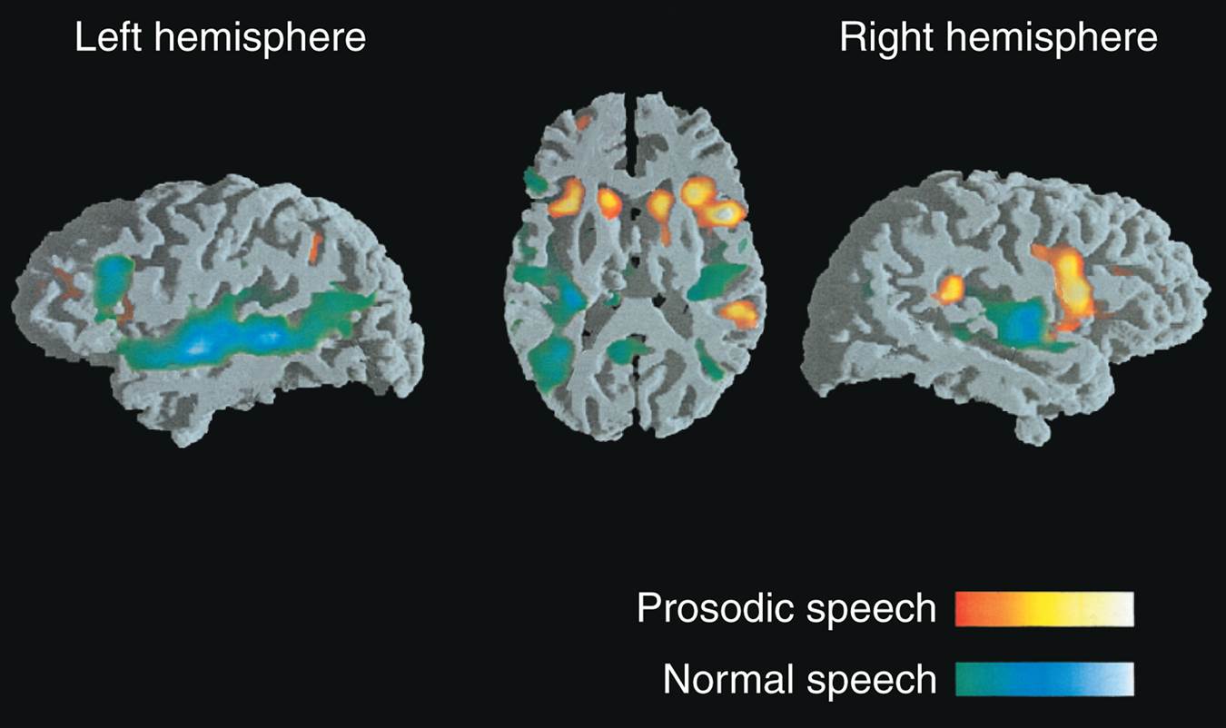 Listening to Normal Speech or Its Prosodic Components Functional MRI scans were made while subjects 