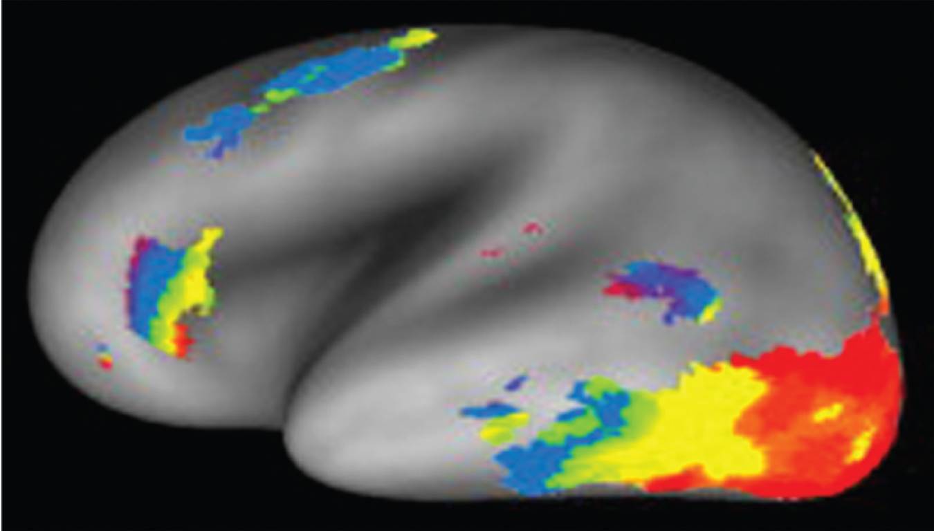 These examples of stimuli were used in the experiment by Vinckier et al. (2007). Mouton is the Frenc