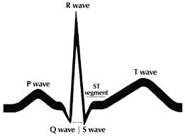 EKG