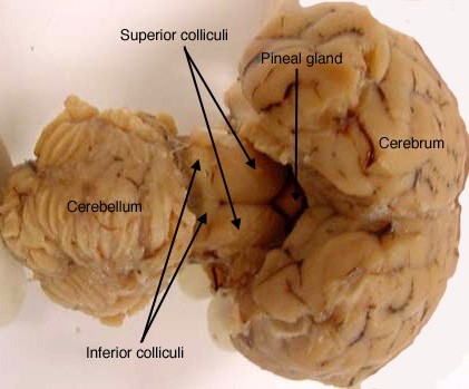 Brain Dissection