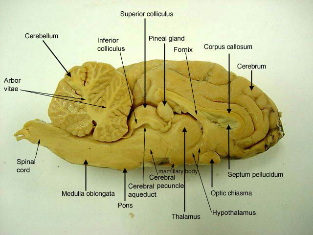 Brain Dissection