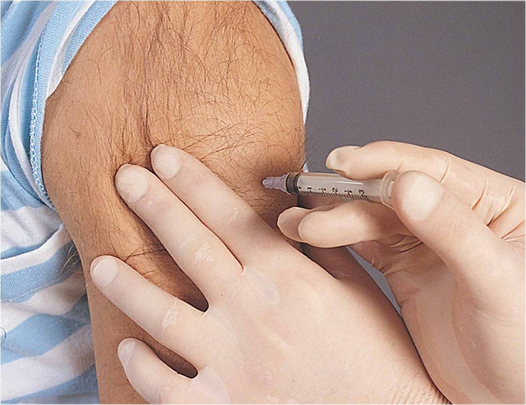 Intramuscular drug administration: (c) the needle is inserted at a 90° angle: Source: Pearson Educat