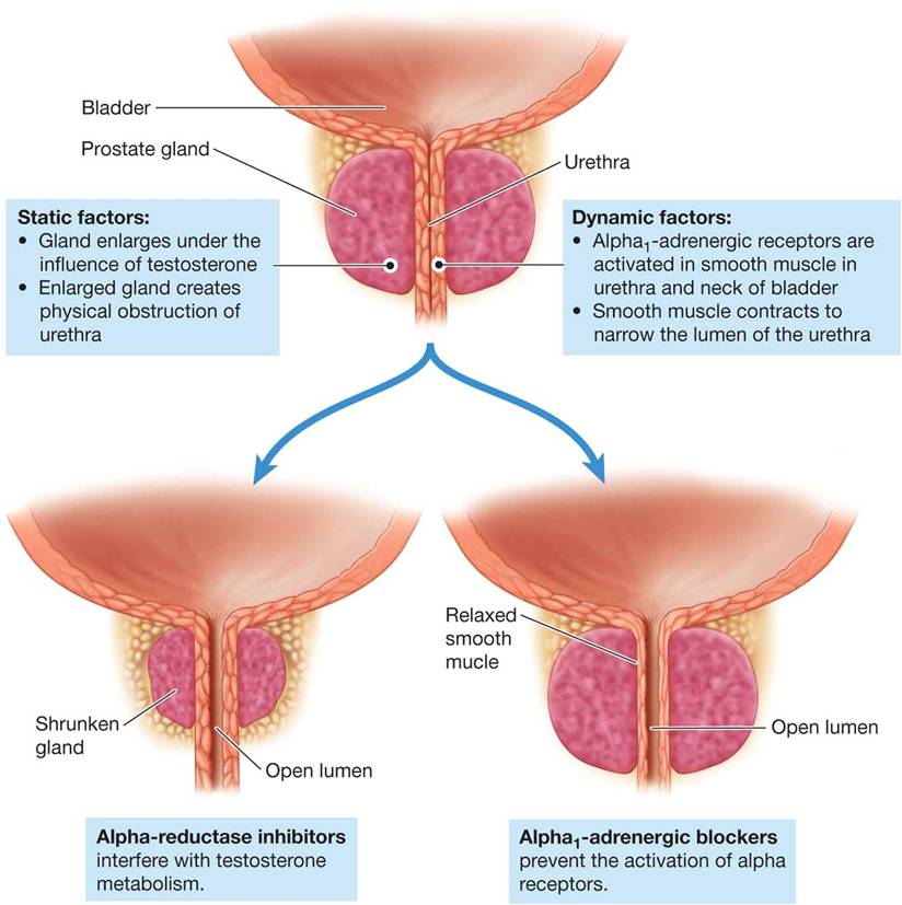 Mechanisms of Action of Antiprostatic Drugs