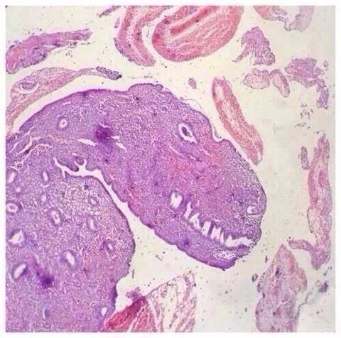 A t-rex hiding under the microscope