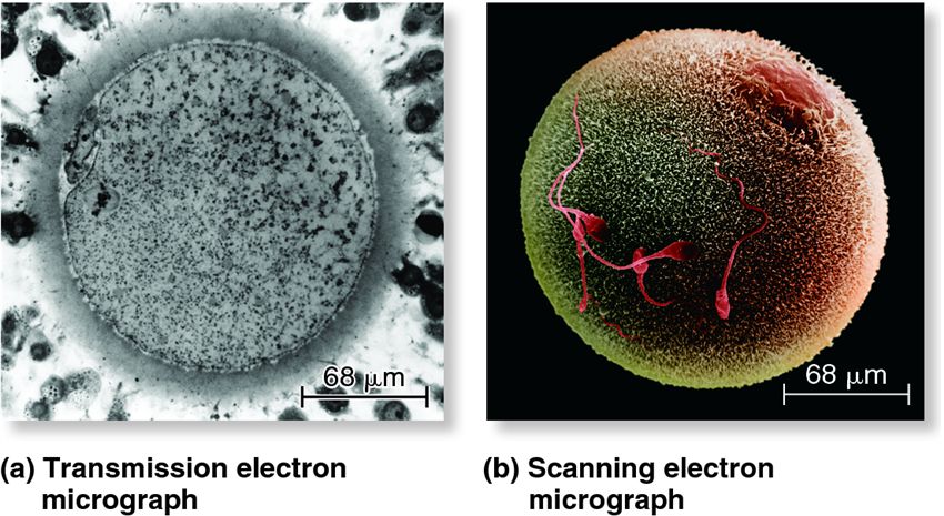 A comparison of transmission and scanning electron microscopy