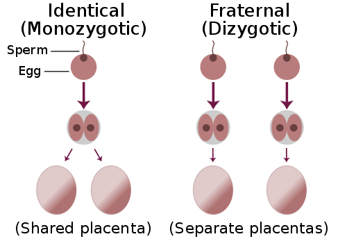 Monozygotic versus Dizygotic Twins